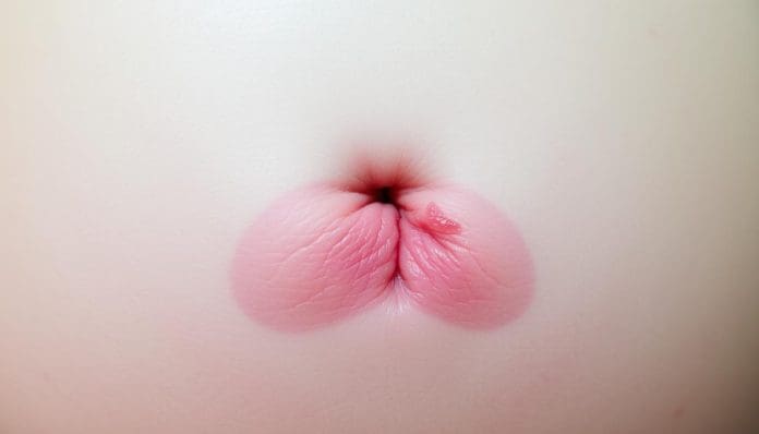 علامات التئام جرح القيصرية